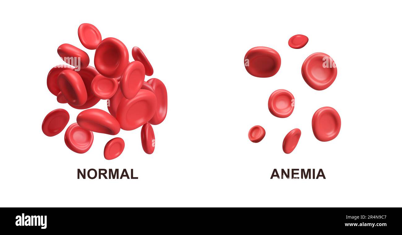 3d flusso di globuli rossi ferro piastrine eritrociti. Normale e anemia. Rappresentazione realistica dell'analisi medica su sfondo bianco con tracciato di ritaglio Foto Stock