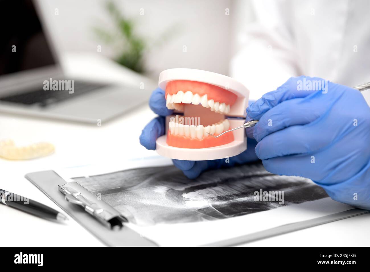 Il dentista mostra aree problematiche nei denti della mandibola artificiale Foto Stock