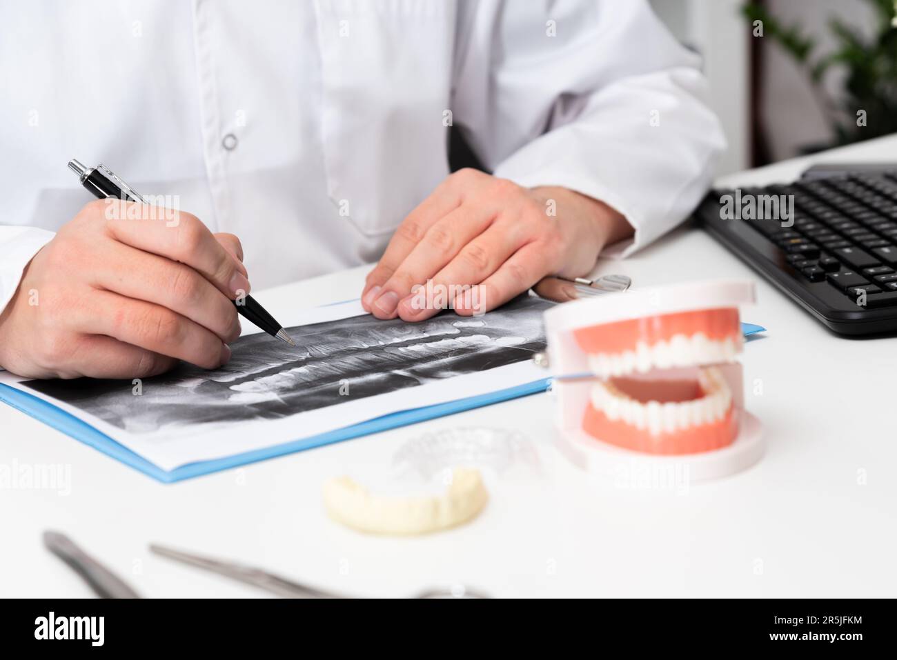Il dentista mostra aree problematiche nei denti della mandibola artificiale Foto Stock