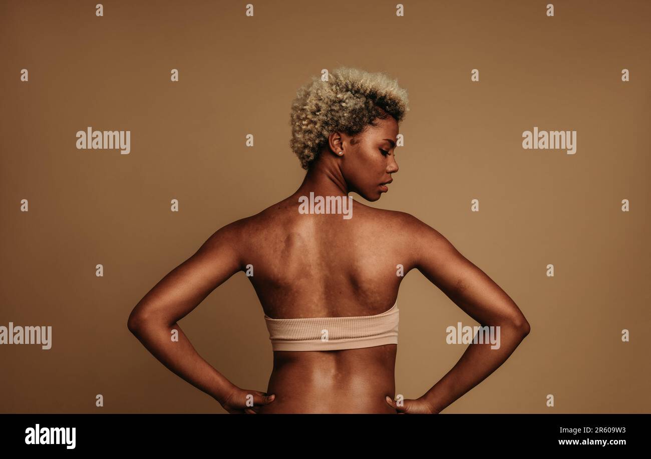 La giovane donna potenziata si alza fiduciosa e orgogliosa in uno studio, abbracciando il suo tono di pelle unico e la carnagione ricca di melanina con macchie solari sul bac Foto Stock