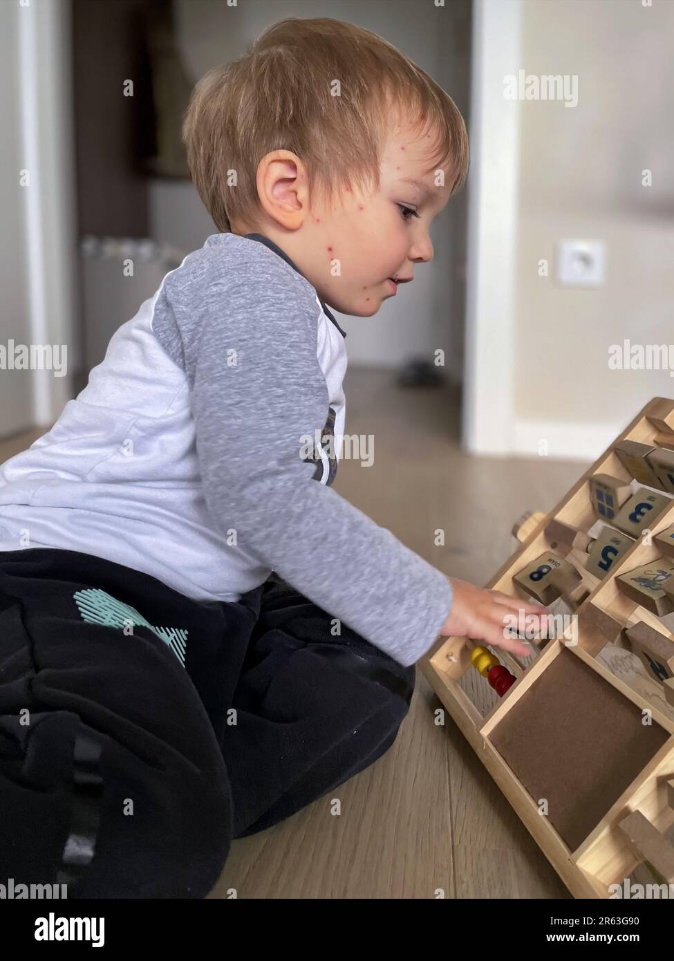 Bambino piccolo con eruzioni di bolla di varicella che gioca sul pavimento Foto Stock