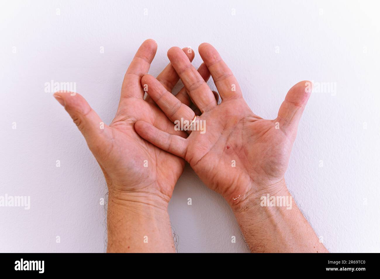 Mani ravvicinate uomo di mezza età, in crepe, rughe, con pelle secca, con calli Foto Stock