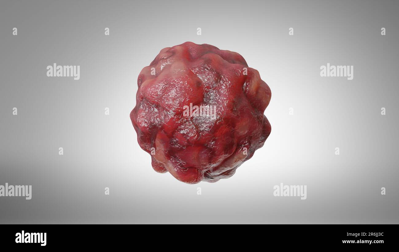 Crescita delle cellule tumorali incontrollabile sui tessuti, cellule di infezione tumorale e diffusione, infiammazione invasiva e metastasi cancerose. riproduci Foto Stock