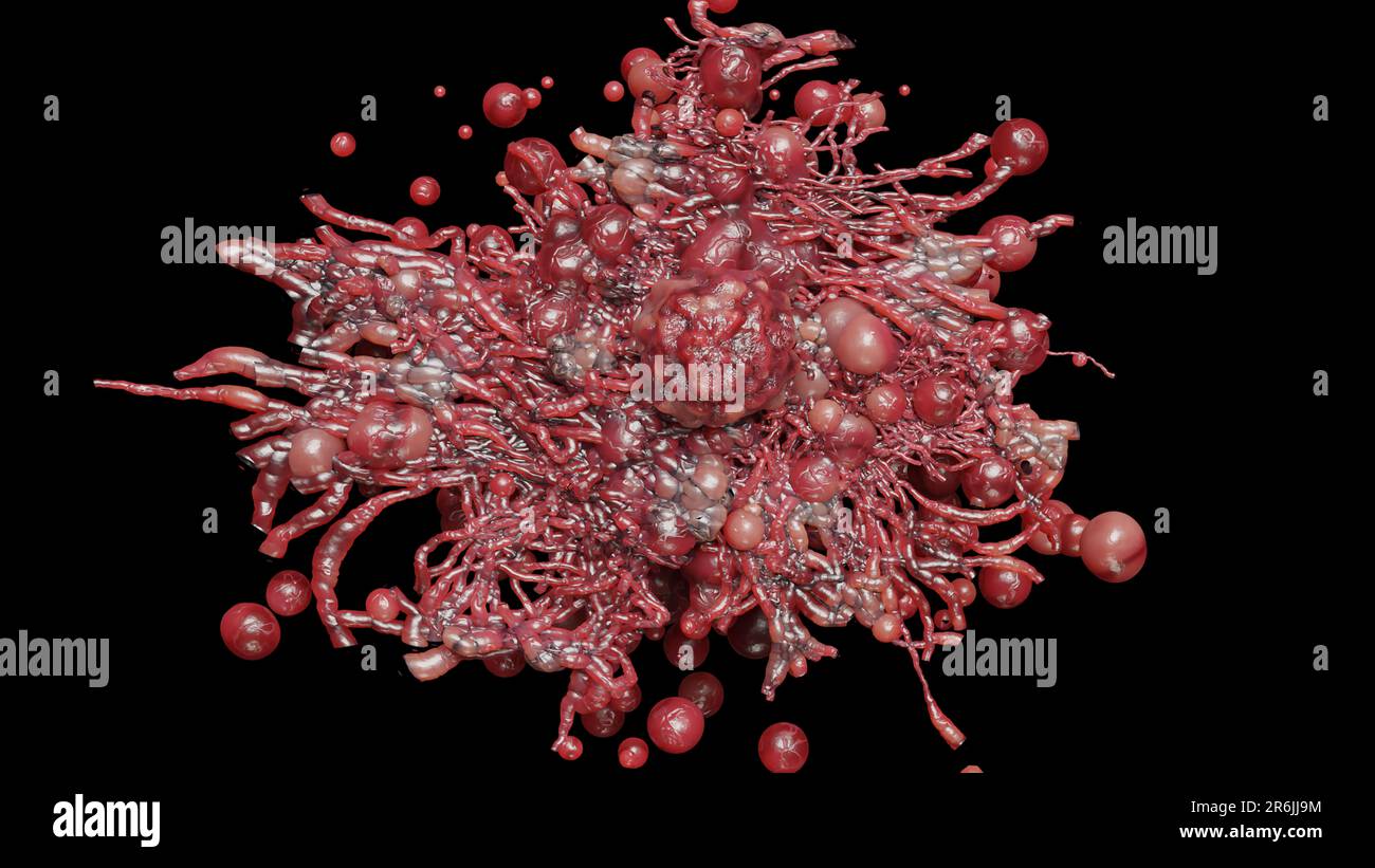 Crescita delle cellule tumorali incontrollabile sui tessuti, cellule di infezione tumorale e diffusione, infiammazione invasiva e metastasi cancerose. riproduci Foto Stock
