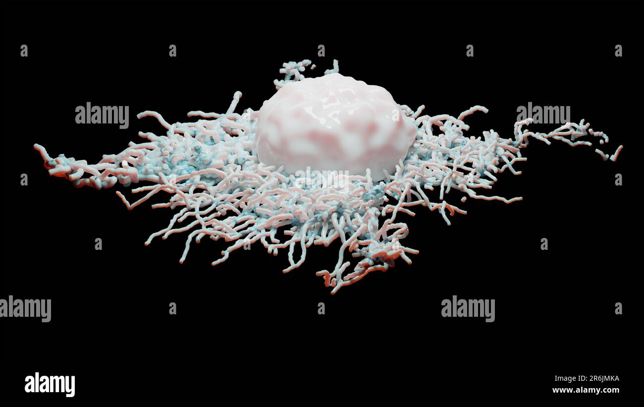 Crescita delle cellule tumorali incontrollabile sui tessuti, cellule di infezione tumorale e diffusione, infiammazione invasiva e metastasi cancerose. riproduci Foto Stock