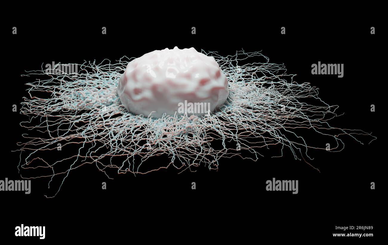 Crescita delle cellule tumorali incontrollabile sui tessuti, cellule di infezione tumorale e diffusione, infiammazione invasiva e metastasi cancerose. riproduci Foto Stock