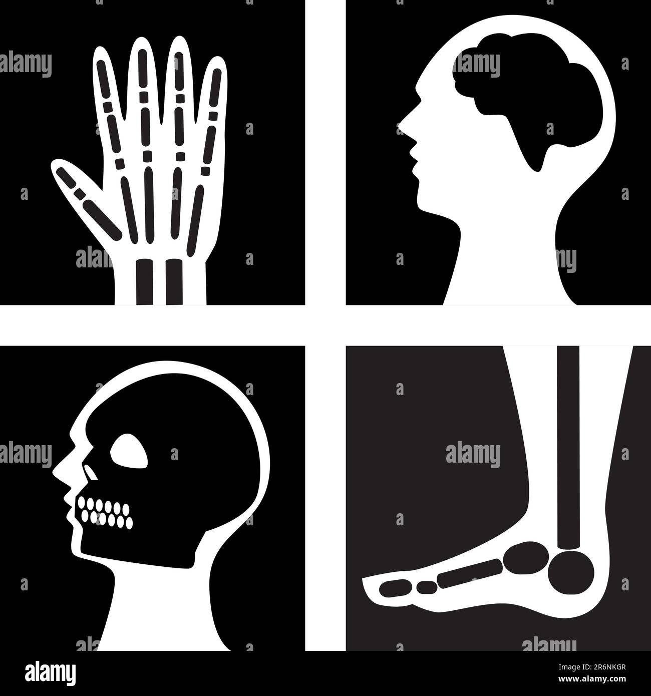 Set di 4 diversi raggi X del corpo. Illustrazione Vettoriale
