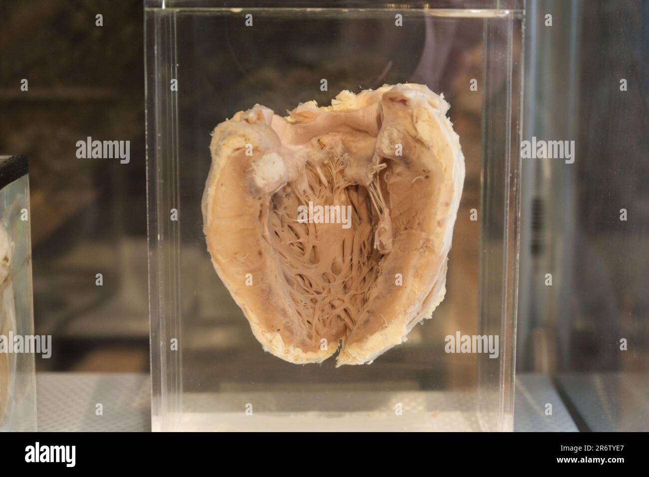 Un cuore umano preservato Foto Stock