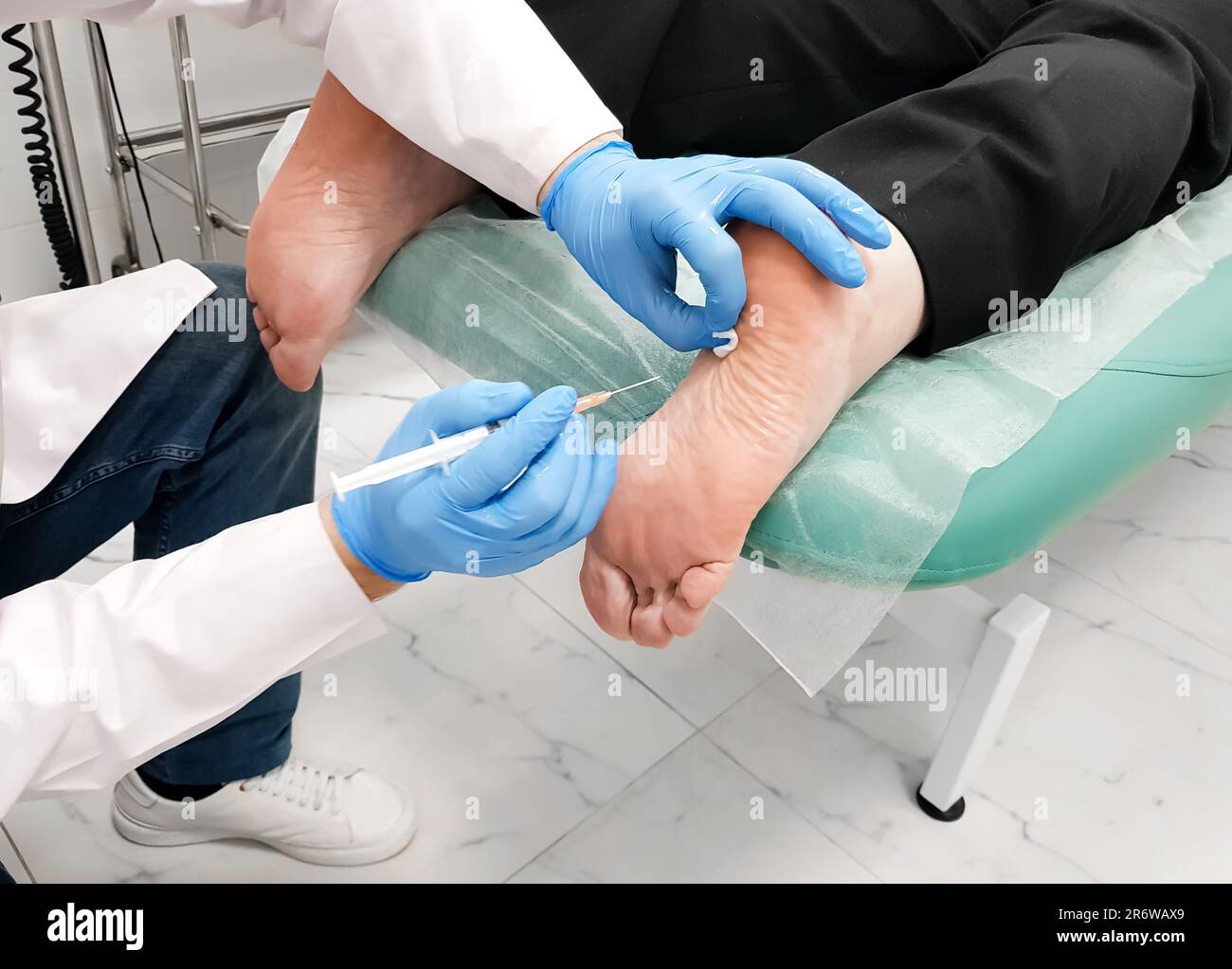 Il medico fa iniezione blocco medico di farmaci ormonali di glucocorticoidi al tallone del paziente. Visita al chirurgo ortopedico. Alleviare il trattamento del dolore proc Foto Stock