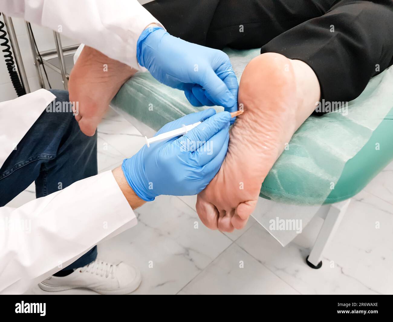 Il medico fa iniezione blocco medico di farmaci ormonali di glucocorticoidi al tallone del paziente. Visita al chirurgo ortopedico. Alleviare il trattamento del dolore proc Foto Stock