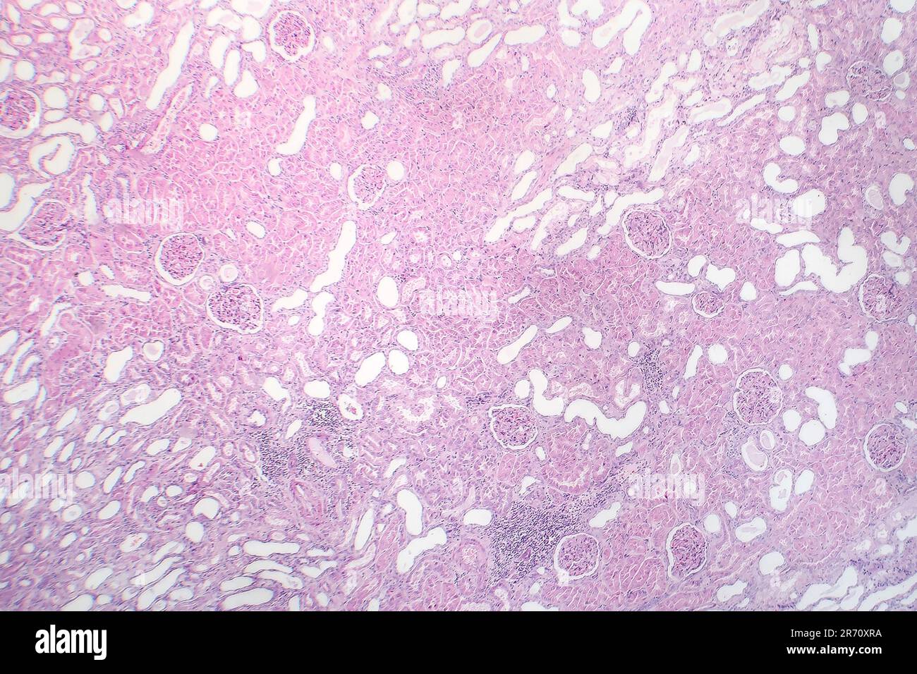 Tessuto epiteliale del rene microscopio immagini e fotografie stock ad ...