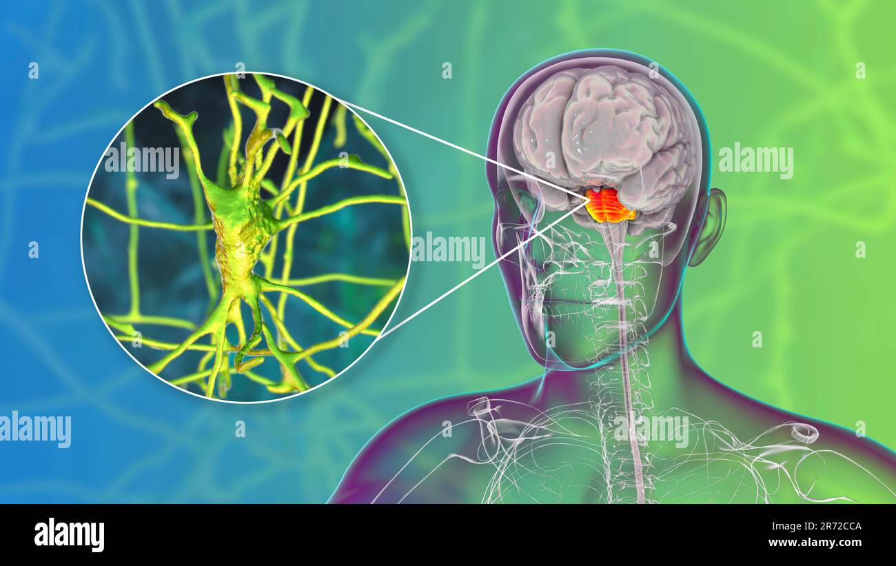 Cervello umano con pons e neuroni evidenziati, illustrazione. Cervello umano con pons Varolii evidenziato e vista ravvicinata di neuroni piramidali (nervo c Foto Stock