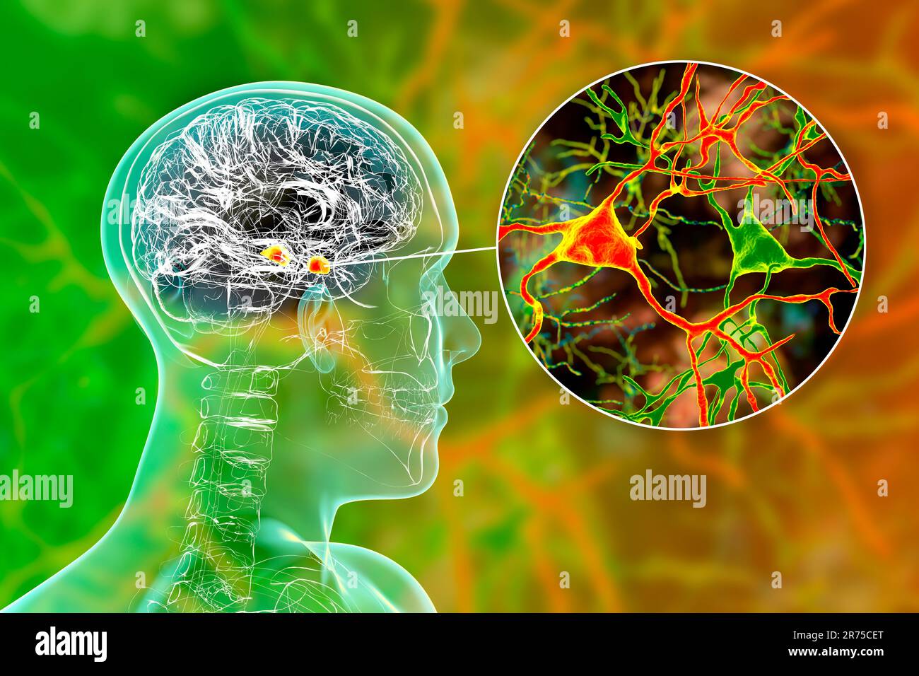 Amigdala nel cervello, e vista closeup dei neuroni amigdala, illustrazione del computer. Due gruppi di nuclei a forma di mandorla all'interno dei lobi temporali, parte o Foto Stock