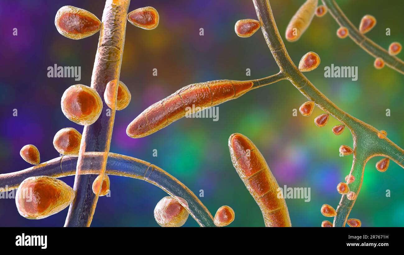 Fungo Trichophyton rubrum, illustrazione del calcolatore che mostra macroconidia, microconidia e iphae septate. Il T. rubrum è un dermatofita antropofilo. Foto Stock