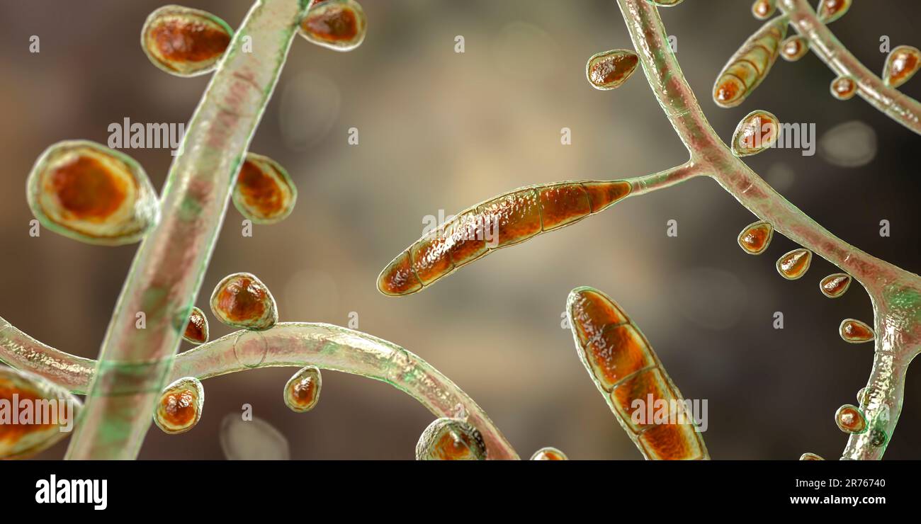 Fungo Trichophyton rubrum, illustrazione del calcolatore che mostra macroconidia, microconidia e iphae septate. Il T. rubrum è un dermatofita antropofilo. Foto Stock