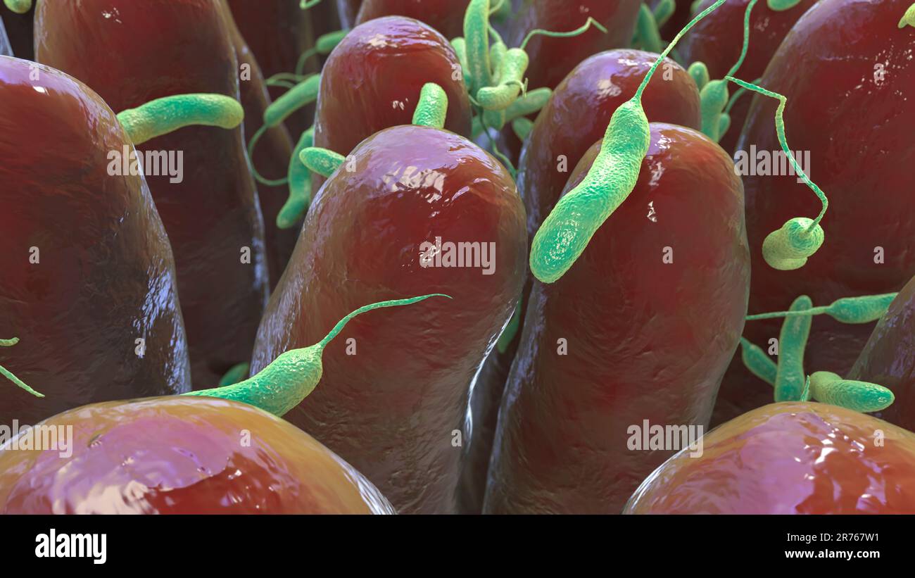 Batteri del colera (Vibrio cholerae) nell'intestino tenue umano, illustrazione del calcolatore. Foto Stock