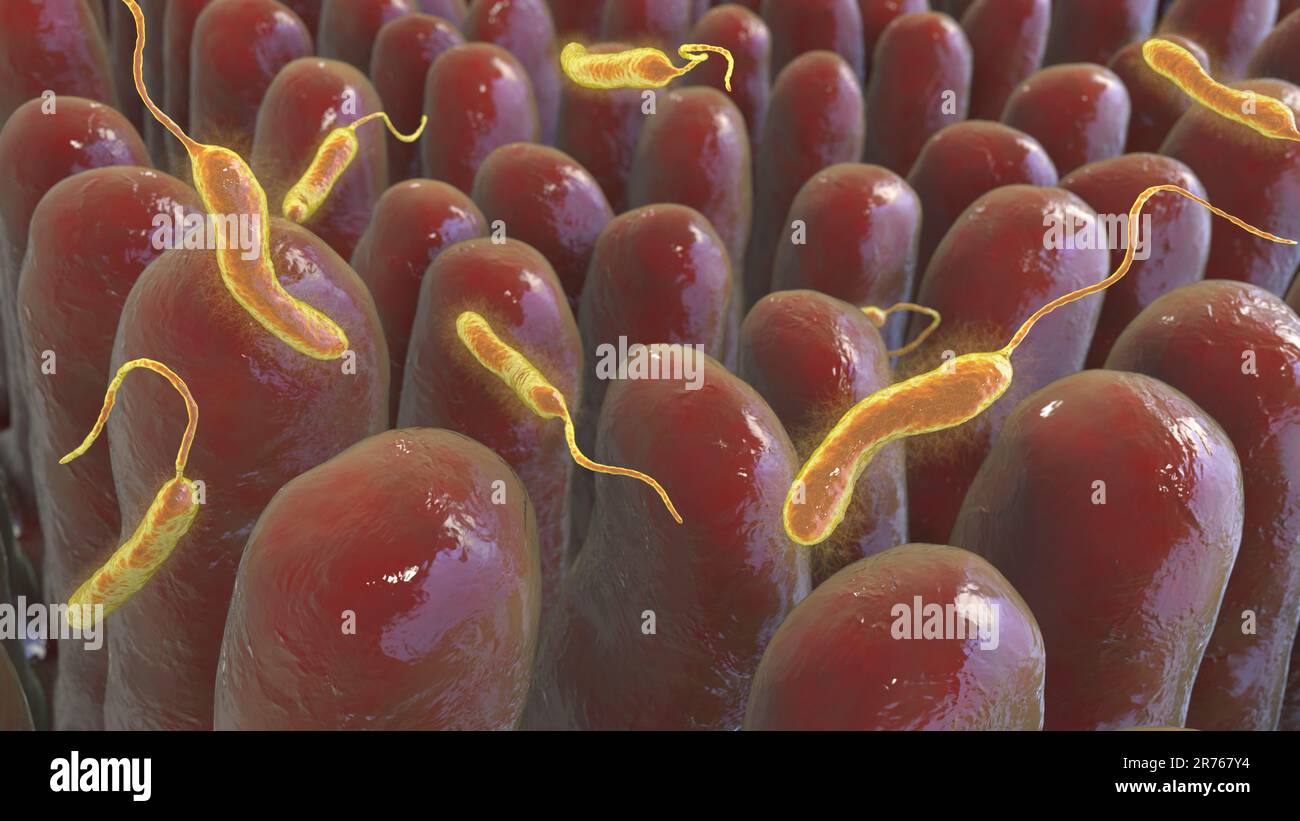 Batteri del colera (Vibrio cholerae) nell'intestino tenue umano, illustrazione del calcolatore. Foto Stock