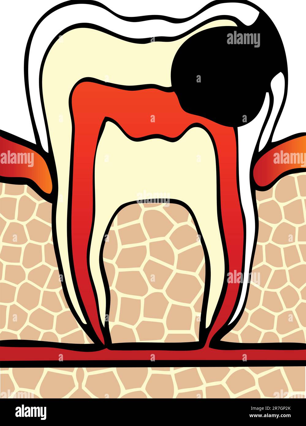 sintomi illustrazione del vettore della cavità dentale Illustrazione Vettoriale