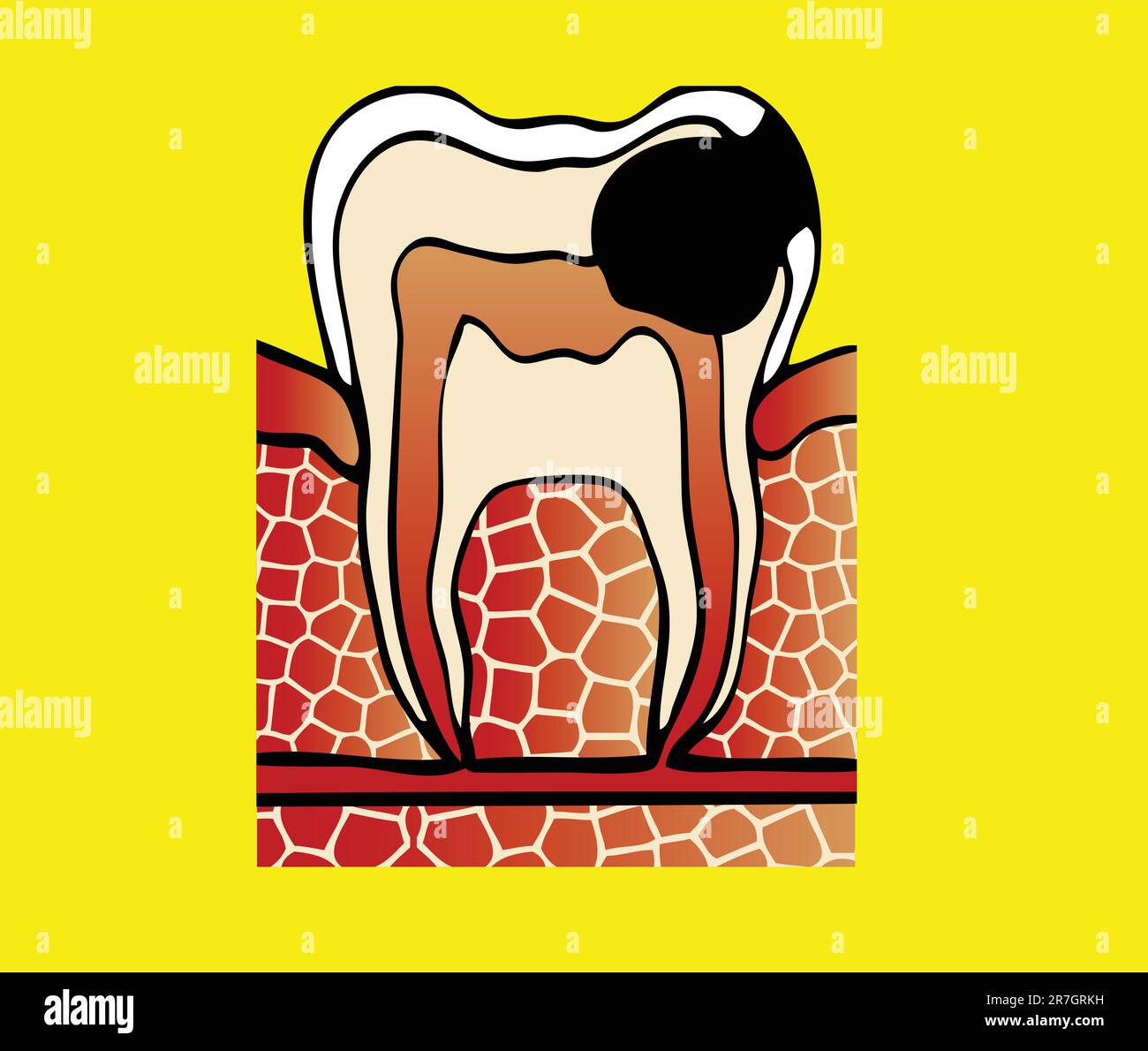 sintomi illustrazione del vettore della cavità dentale Illustrazione Vettoriale