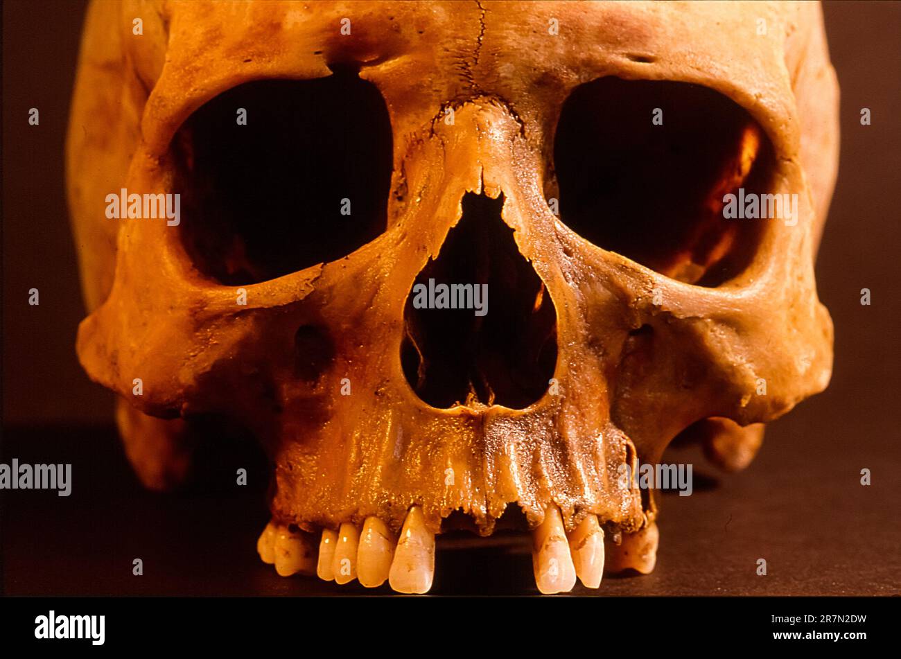 Italia Campania Pompei villa Moregine, gli scavi archeologici - cranio dell'uomo morte durante l'eruzione del vulcano Vesuvio Foto Stock