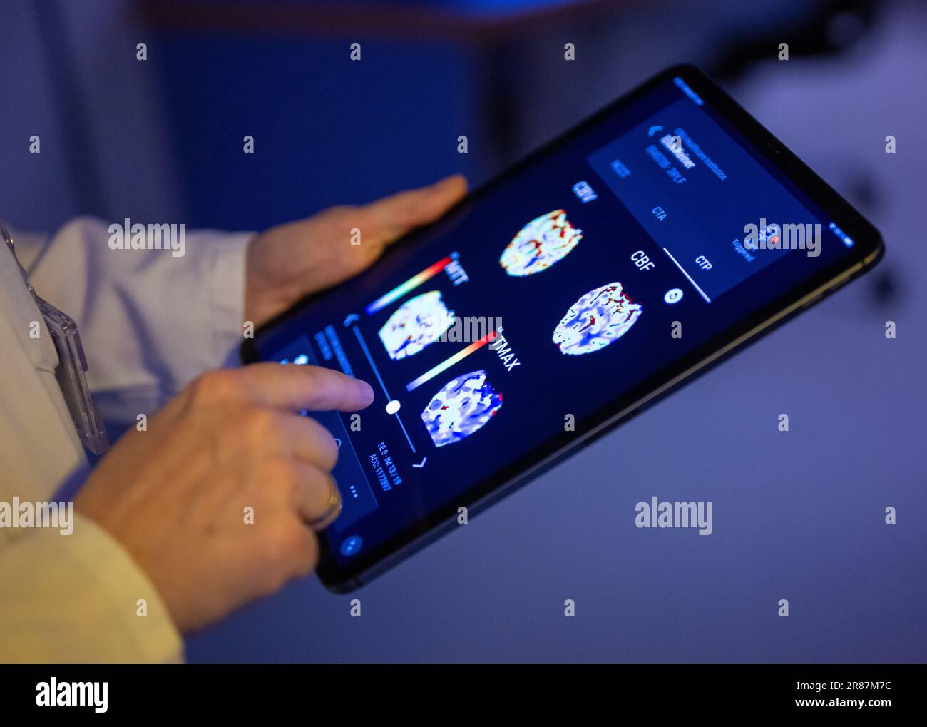 Berlino, Germania. 19th giugno, 2023. Un radiologo dell'Unfallkrankenhaus Berlin guarda le immagini cerebrali di un paziente in un'app basata sull'intelligenza artificiale su un tablet. Al fine di curare i pazienti con ictus in situazioni acute ancora più rapidamente in futuro, Unfallkrankenhaus Berlin vuole espandere l'uso dell'intelligenza artificiale (ai). (To dpa: 'Unfallkrankenhaus wants to improve patient care through ai') Credit: Monika Skolimowska/dpa/Alamy Live News Foto Stock