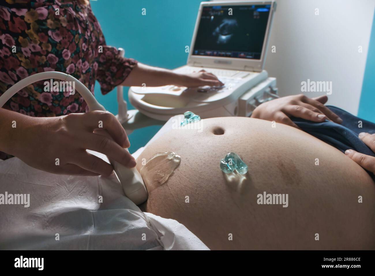 Primo piano della pancia grande di una donna incinta sdraiata su un letto di ospedale che è dato una scansione ecografica di gravidanza con uno strumento ultrasonico da un doc Foto Stock