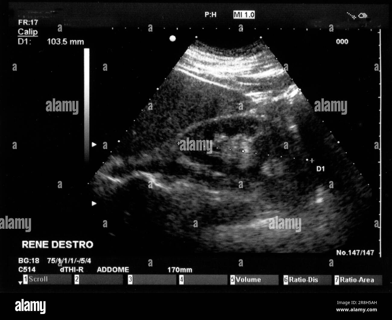 Rene umano Foto e Immagini Stock in Bianco e Nero - Alamy