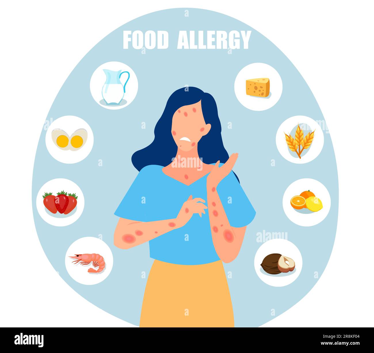 Vettore di una giovane donna che ha sintomi di allergia alimentare, eruzione cutanea Illustrazione Vettoriale