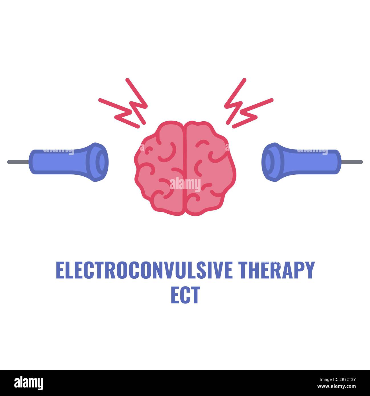 Terapia elettroconvulsiva, illustrazione Foto Stock