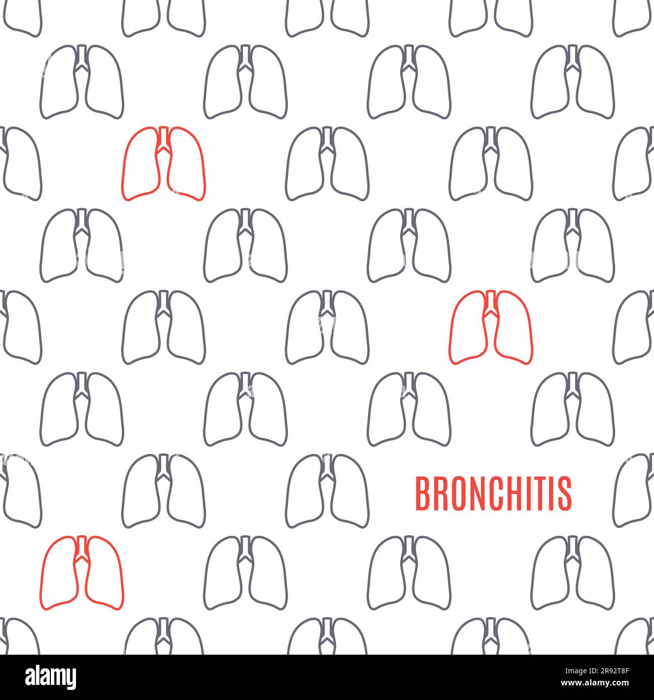 Bronchite, illustrazione concettuale Foto Stock