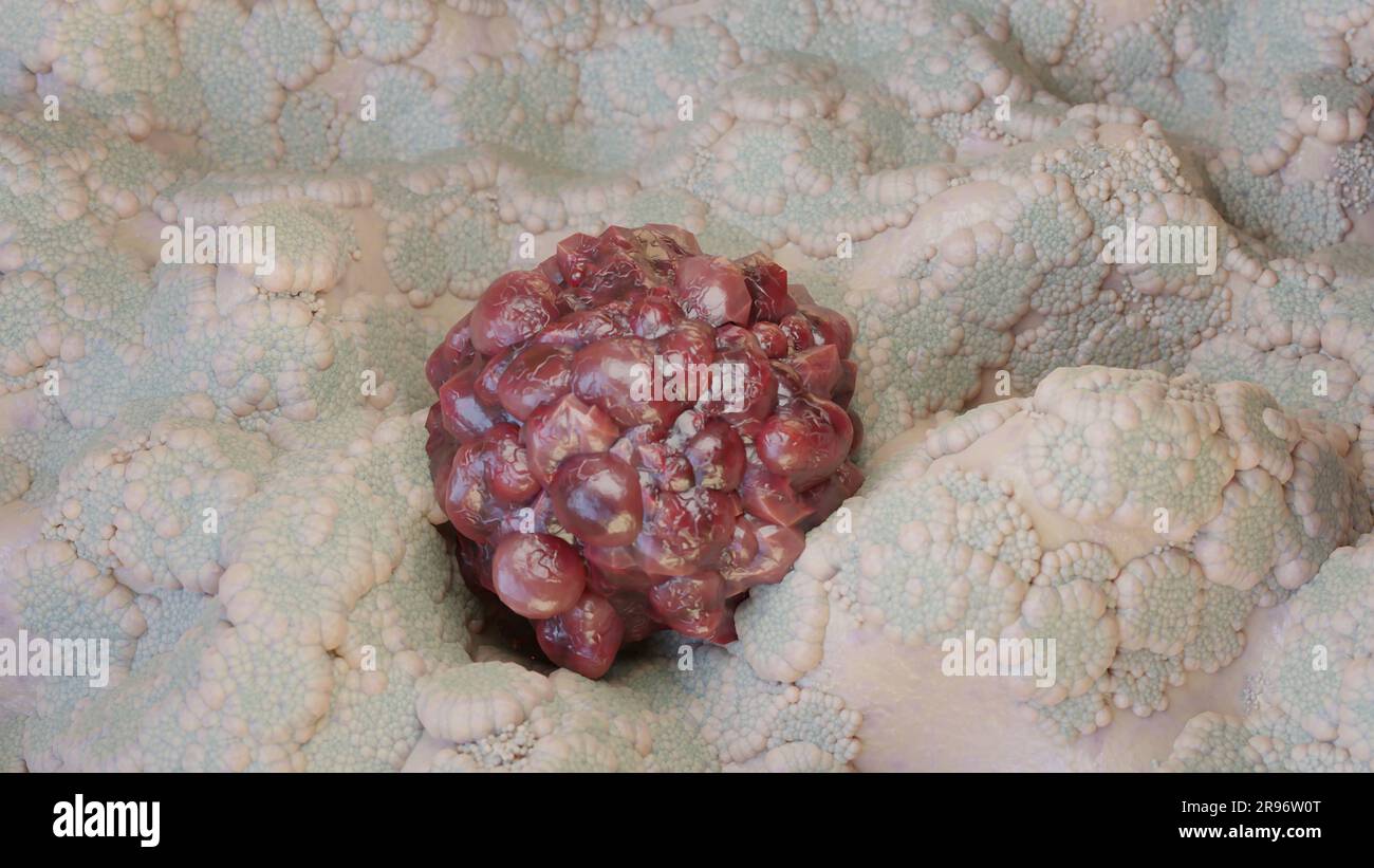 Crescita delle cellule tumorali incontrollabile sui tessuti, cellule di infezione tumorale e diffusione, infiammazione invasiva e metastasi cancerose. riproduci Foto Stock