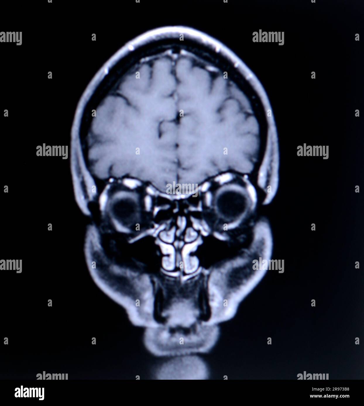 Un cervello umano Foto Stock