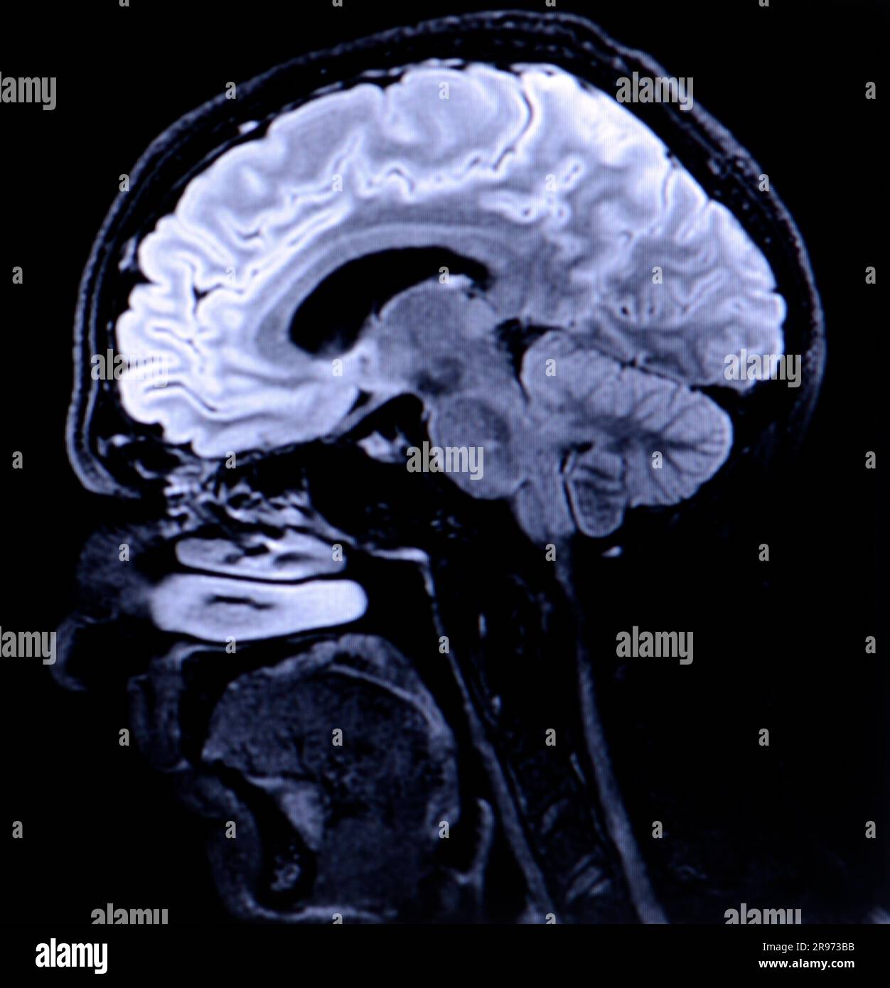 Un cervello umano Foto Stock