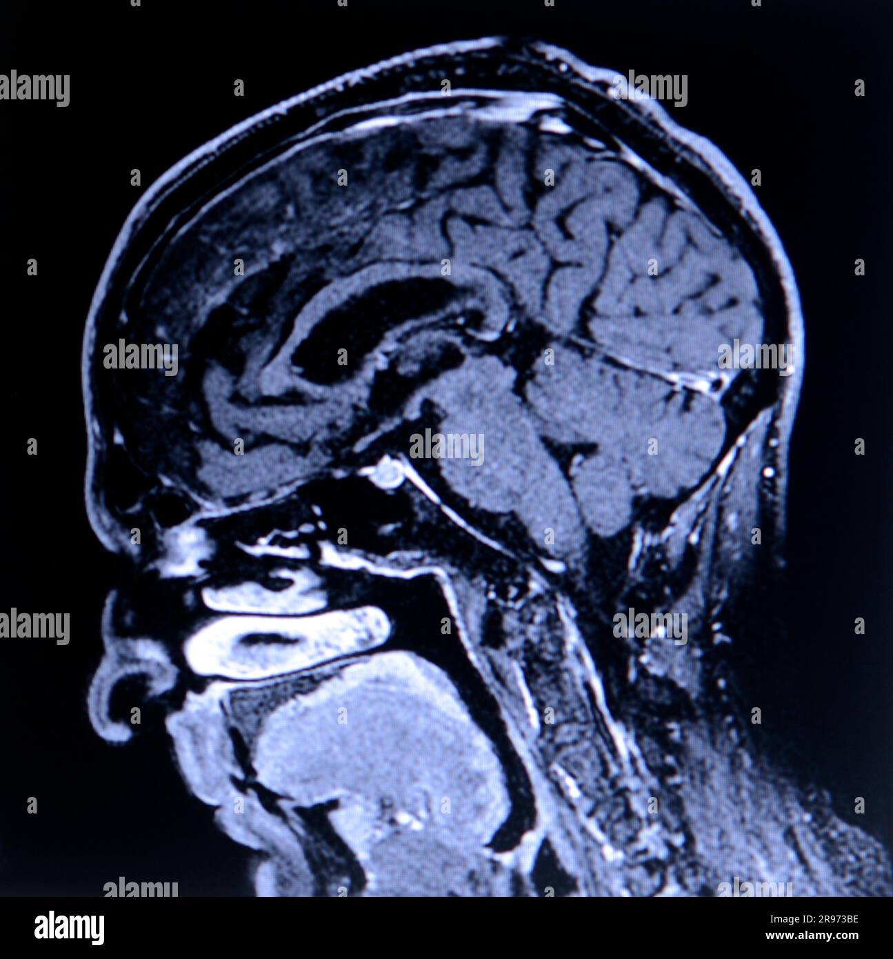 Un cervello umano Foto Stock