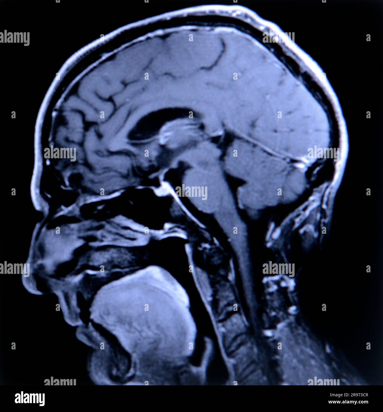 Un cervello umano Foto Stock