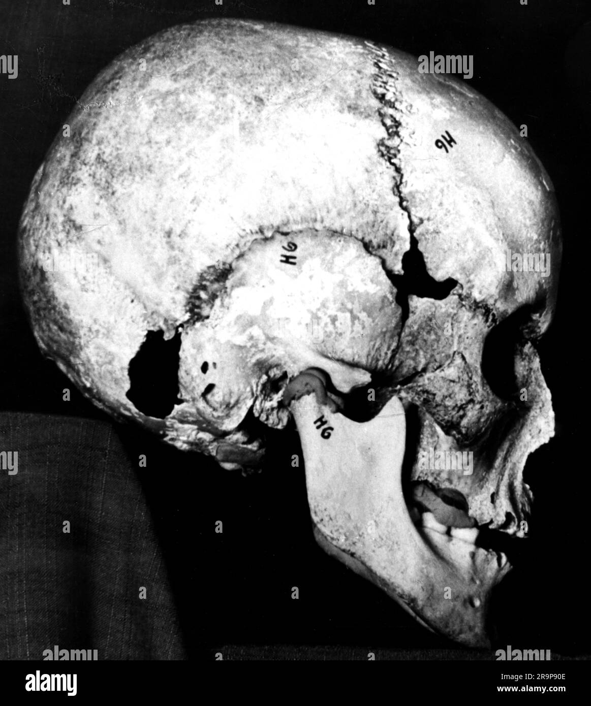 Preistoria, ominide, cranio di un Homo Sapiens, neolitico, AGGIUNTIVO-DIRITTI-CLEARANCE-INFO-NOT-AVAILABLE Foto Stock