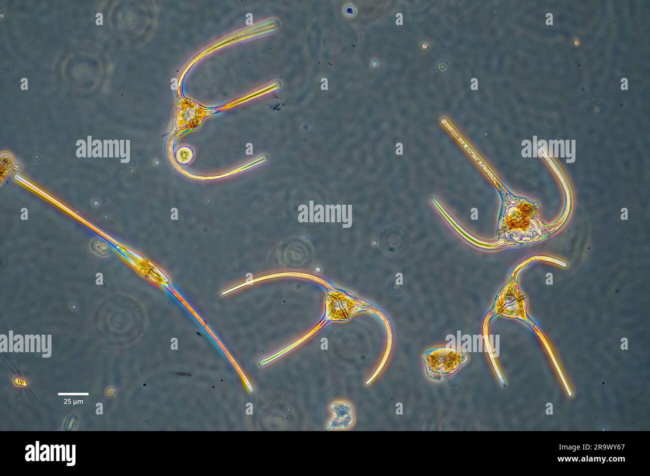 Dinoflagellati planctonici del genere Ceratium raccolti dalle acque superficiali costiere della Norvegia sudoccidentale. Foto Stock