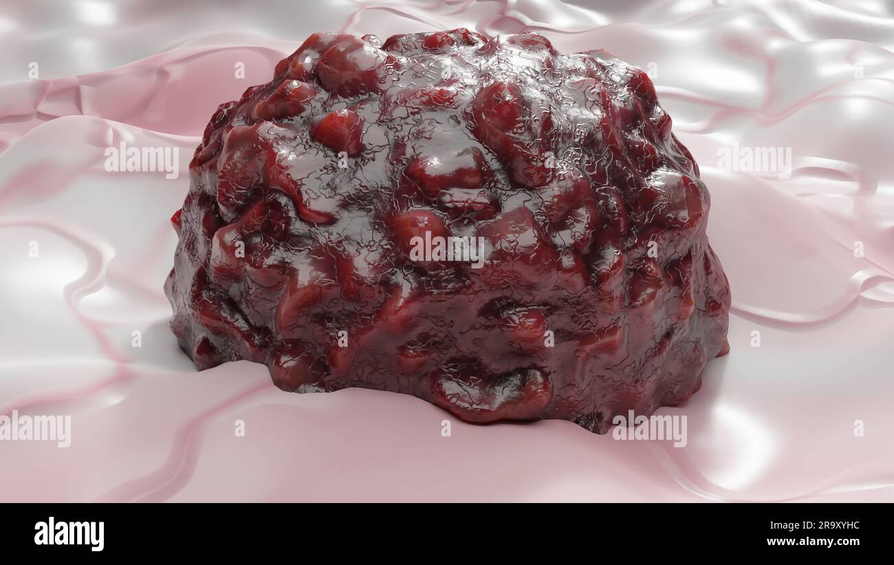 Crescita delle cellule tumorali incontrollabile sui tessuti, cellule di infezione tumorale e diffusione, infiammazione invasiva e metastasi cancerose. riproduci Foto Stock