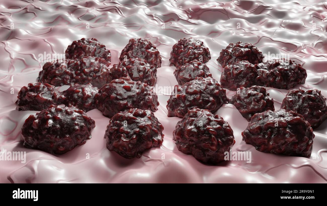 Crescita delle cellule tumorali incontrollabile sui tessuti, cellule di infezione tumorale e diffusione, infiammazione invasiva e metastasi cancerose. riproduci Foto Stock