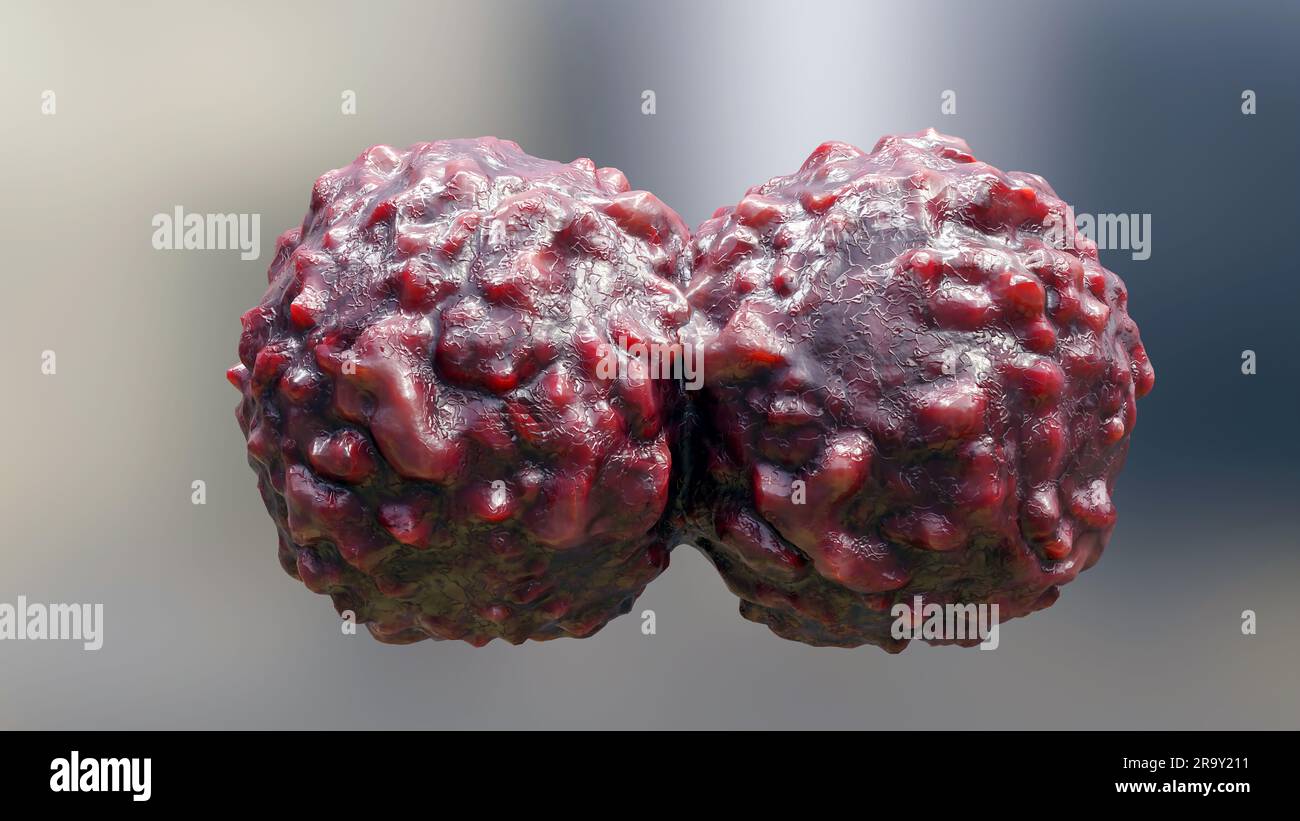 Crescita delle cellule tumorali incontrollabile sui tessuti, cellule di infezione tumorale e diffusione, infiammazione invasiva e metastasi cancerose. riproduci Foto Stock