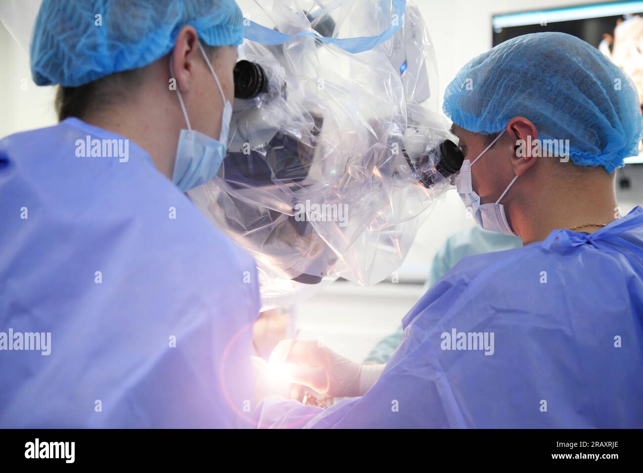 Trattamento di un aneurisma cerebrale. Intervento chirurgico sul cervello. Un team di chirurghi che eseguono interventi di chirurgia cerebrale per rimuovere un tumore. Foto Stock