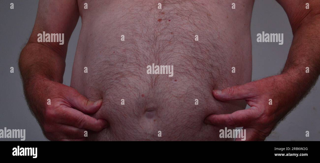 Un uomo anziano o più anziano pizzica la pelle del suo grasso o obeso, stomaco peloso, molto grasso, più la dimensione, considerando una dieta Foto Stock