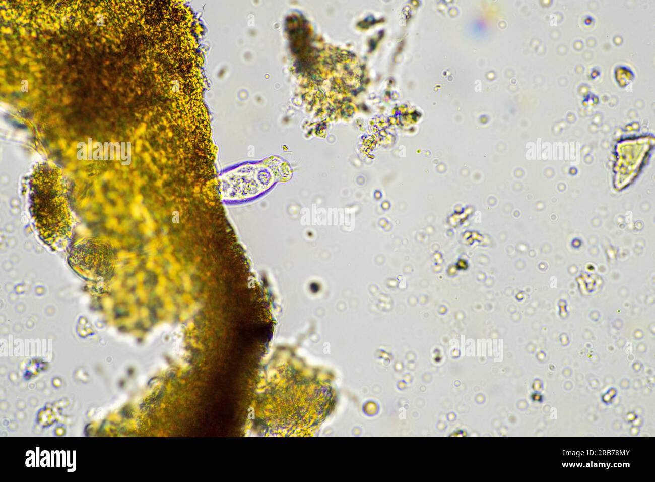 Spore fungine nelle urine (90) 사진