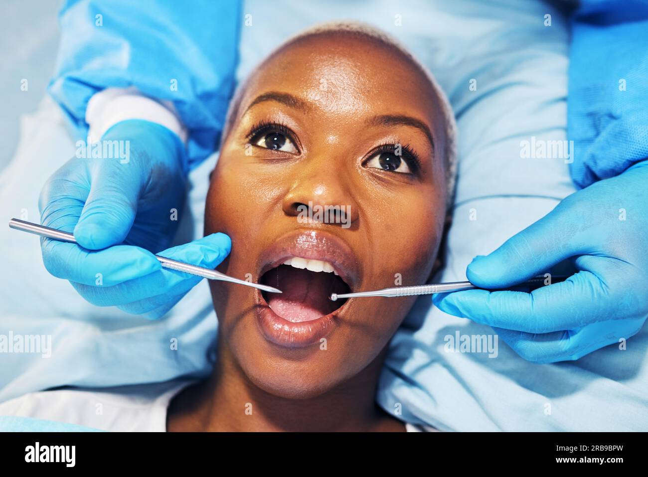 Chirurgo odontoiatrico, donna e strumenti in bocca in clinica per cavità, sbiancamento dei denti e aiuto mano per il dolore. Dentista, paziente africano e vista dall'alto per Foto Stock
