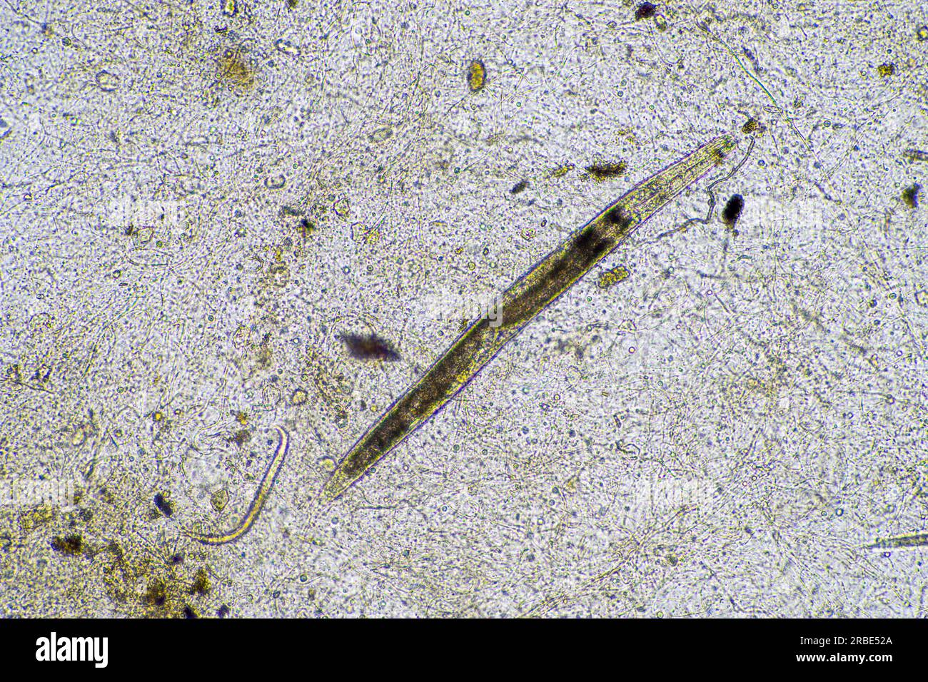 nematode al microscopio in laboratorio Foto Stock