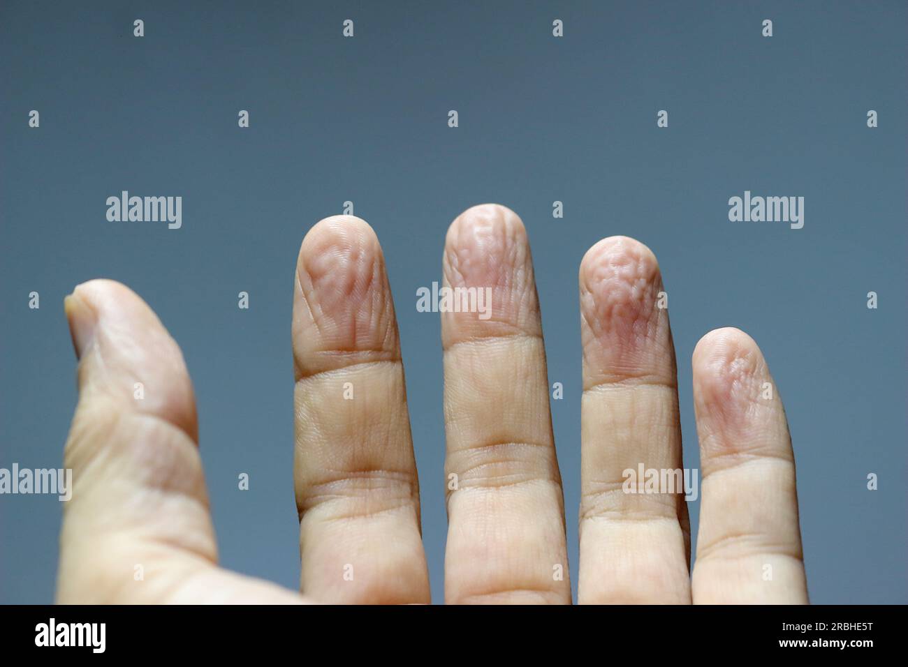 Cinque dita pallide e appassite. Foto Stock