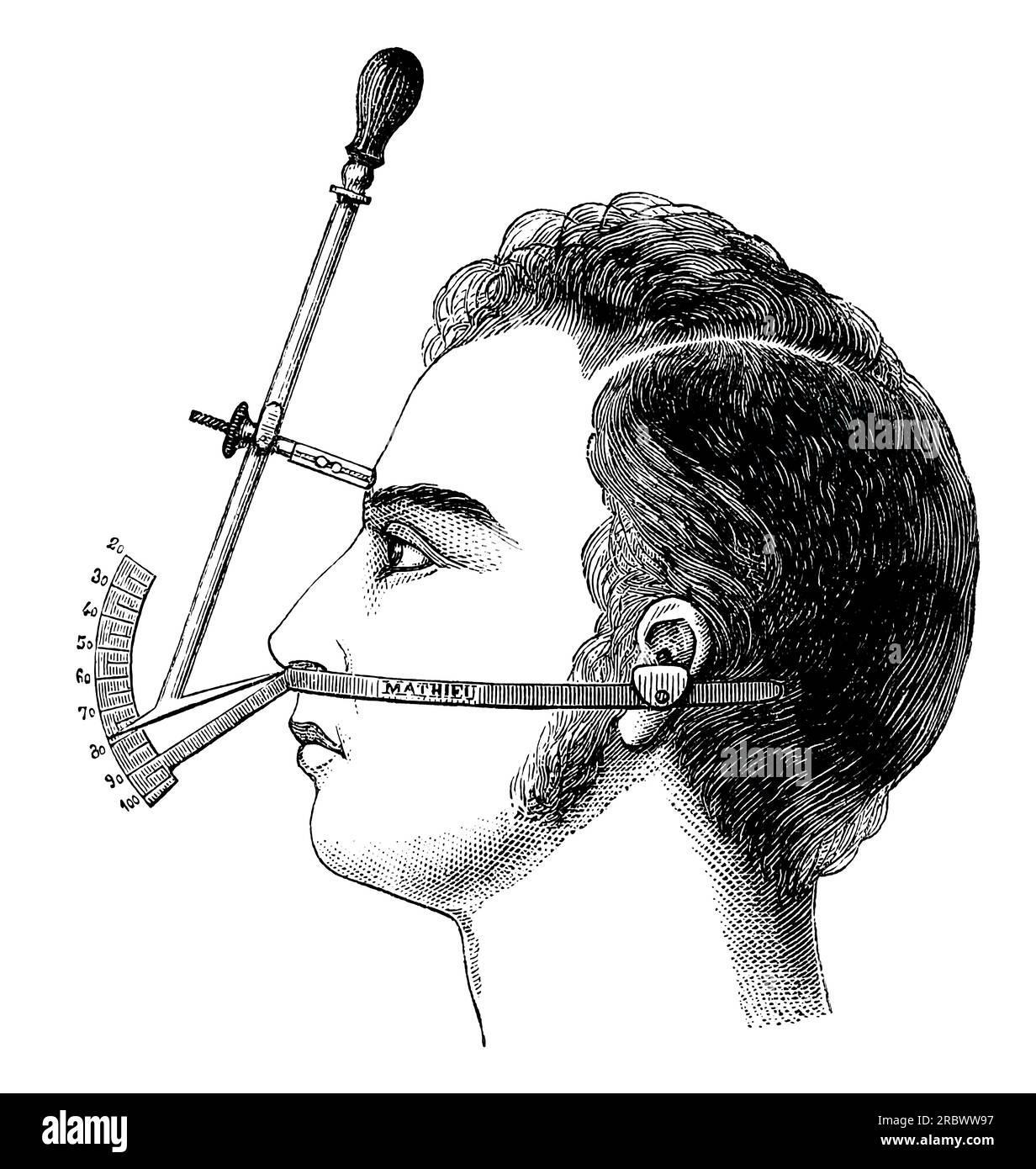 Goniometro facciale mediano di Pierre Paul Broca, 1824–1880, medico francese, anatomista e antropologo Foto Stock