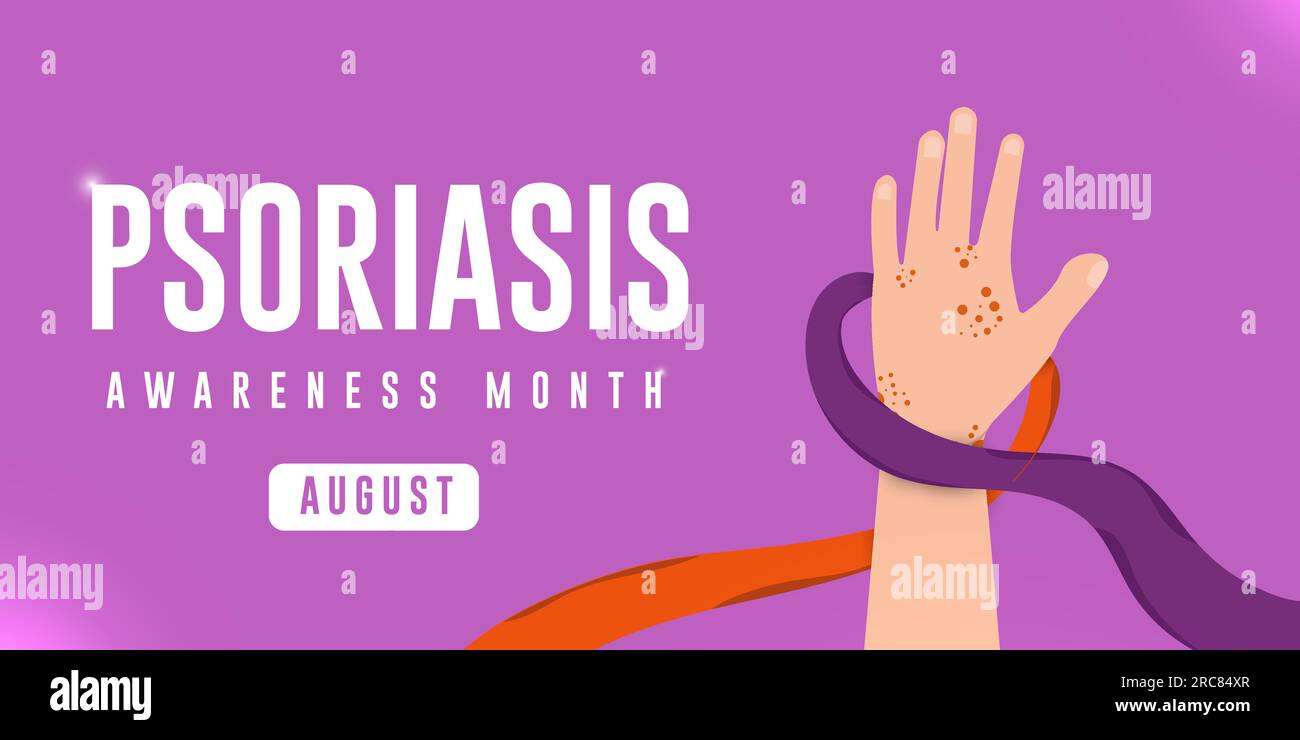 Concetto del mese di sensibilizzazione sulla psoriasi. La mano degli uomini circonda il nastro di colore arancione e viola. Design del poster vettoriale orizzontale. Illustrazione Vettoriale
