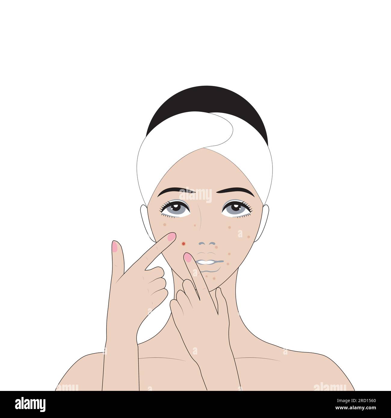 Vettore femmina Pimple Popping. Acne Illustrazione Vettoriale