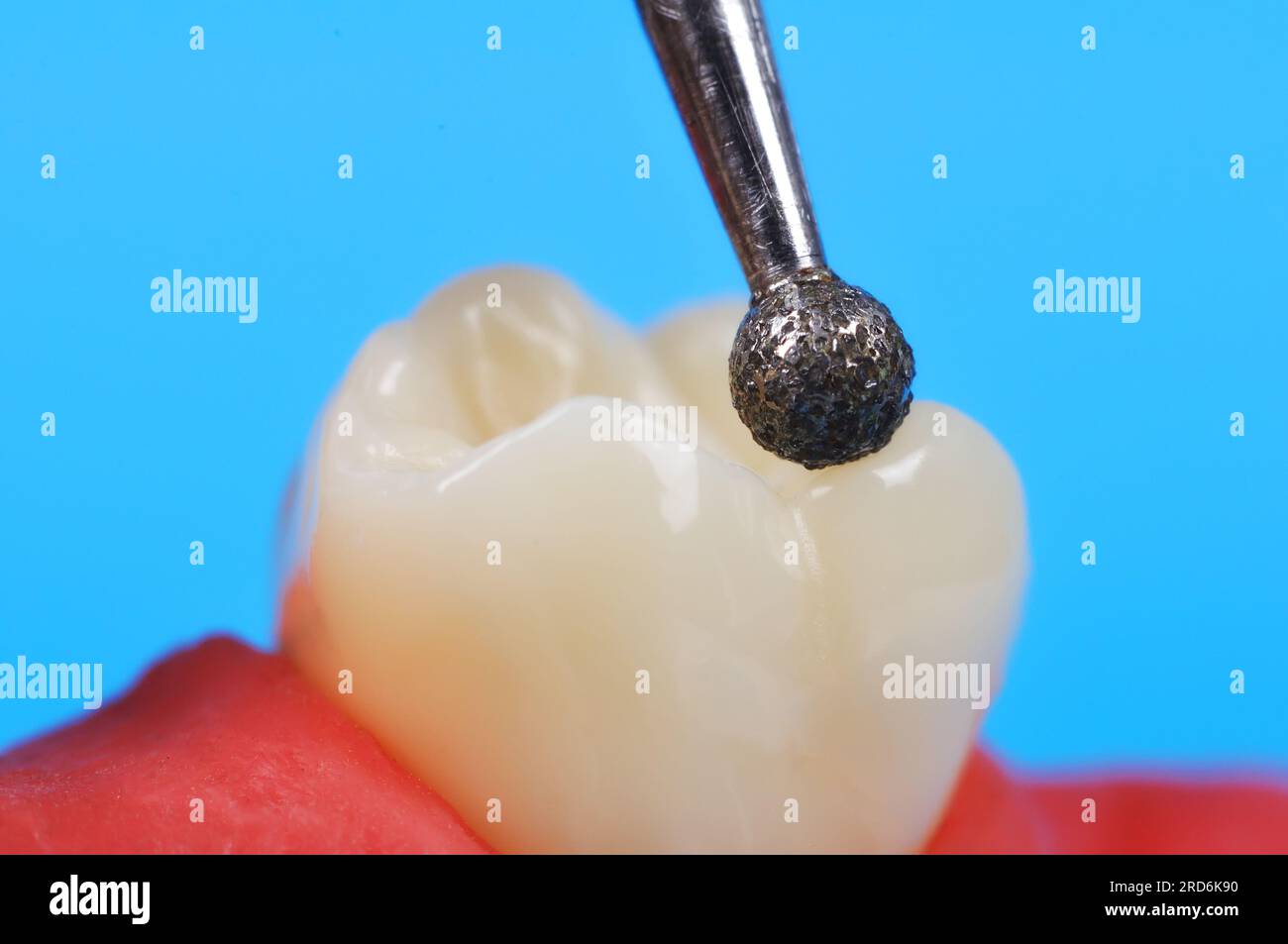Trapano dentistico e dente extra close up Foto Stock